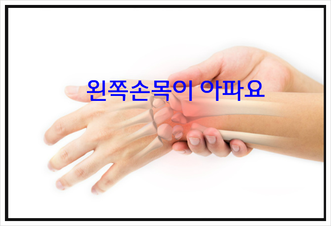 왼쪽 손목이아플때,손목관절염,손목터널증후군