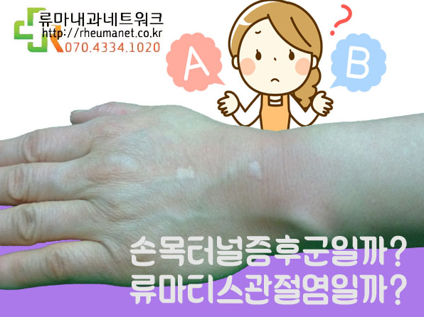 손목터널증후군인줄 알았는데 다른 질환 때문?