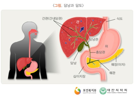 위경련으로 인한 통증과 소화불량, 면역력저하 (만성담낭염 !!