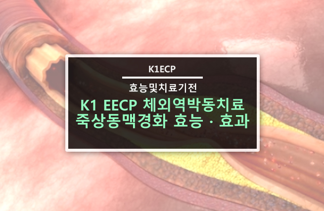 K1 EECP 체외역박동치료 !!