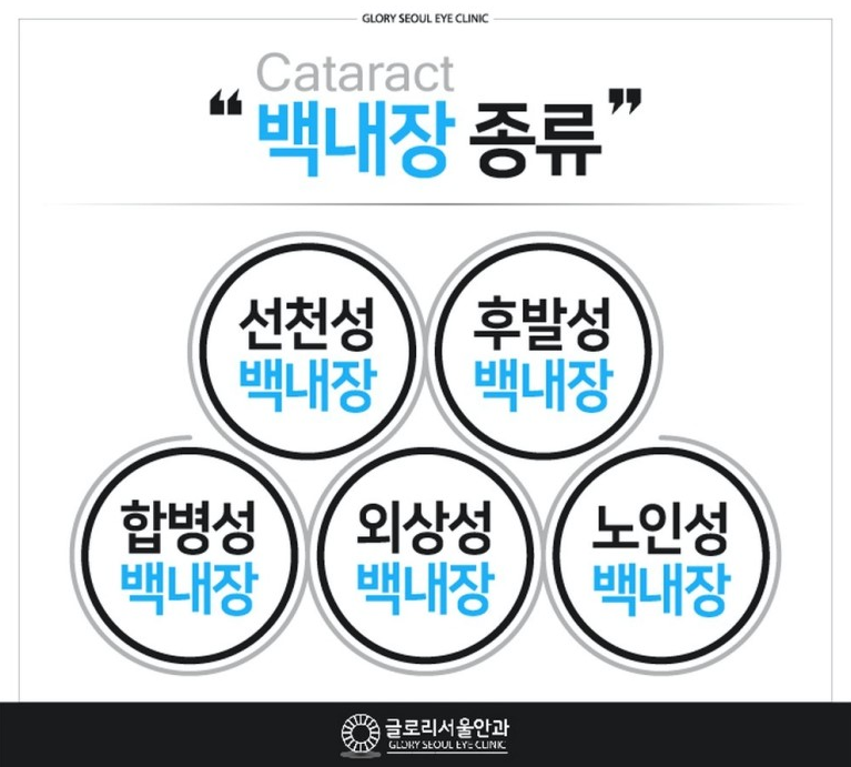 영통2동백내장 수술 잘하는 병원 정보 공개!