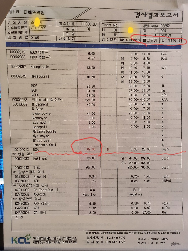 줄기세포치료 후기 봅시다