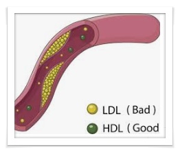 HDL 콜레스테롤의 장점에 대해