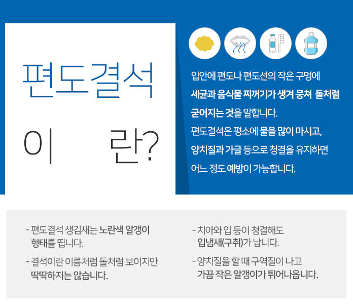 결석이 쉽게 생길 수 있는 만성편도염