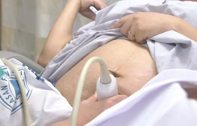 노란 수영복에 섹시한 몸매 어필하는 존예 처자