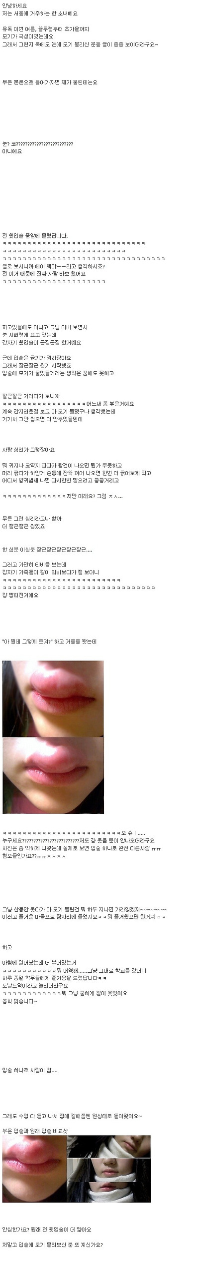 웃으면 안되지만....입술에 모기물린여자ㅋㅋㅋㅋㅋㅋㅋㅋㅋㅋㅋ - 악플달면 쩌리쩌려버려 - ＊여성시대＊ 차분한 20대들의 알흠다운 공간