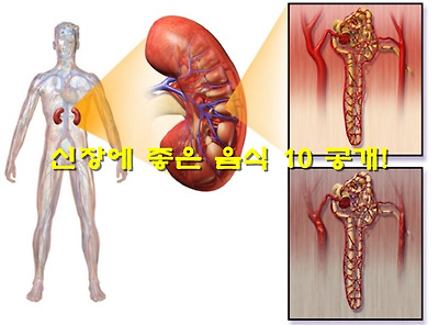 신장에 좋은 음식 10_1