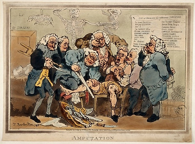 사진: 중세 유럽의 끔찍한 수술 장면을 묘사한 그림. 마취도 없이 환자를 묶어두고 톱으로 다리를 자르고 있다. [삼색등 의미와 외과의사의 역사]