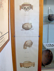 cranial deformation devices...