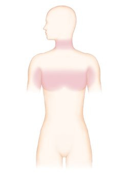 가슴, 등, 겨드랑이, 목 등