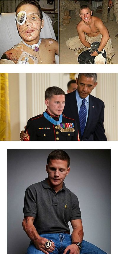 몸으로 수류탄을 막은 미국 군인.png