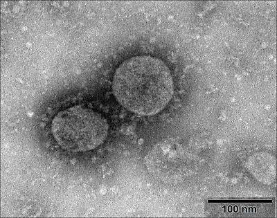 중국 바이러스 질병통제 예방연구소가 발행한 신종코로나 바이러스 현미경 사진