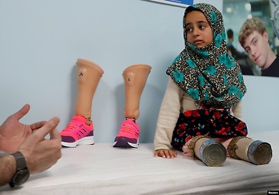 터키 이스탄불에 위치한 의수족 센터에서 시리아 난민인 8살 마야가 의족 수술을 받기 위해 기다리고 있다. 앞서 시리아 난민 캠프에서 AFP 사진작가가 플라스틱 튜브와 캔을 허벅지에 꽂고 걸어다니는 두 부녀의 사진을 찍어 인터넷에 올린 후, 아버지와 딸은 많은 사람의 관심 속에 의족 수술비를 지원받게 됐다.&nbsp;