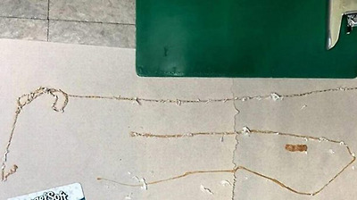 H&igrave;nh ảnh con s&aacute;n d&acirc;y tr&ecirc;n s&agrave;n ph&ograve;ng cấp cứu bệnh viện. Ảnh: B&aacute;c sĩ Kenny Bahn.