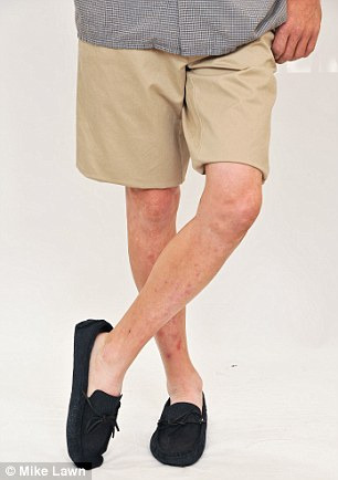 Image result for MEN LEGS IN SHORTS