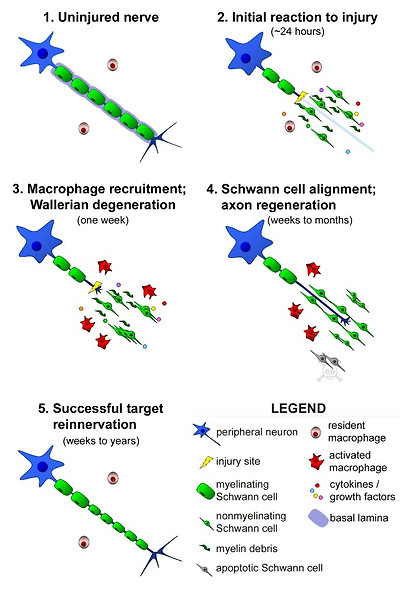 figure1
