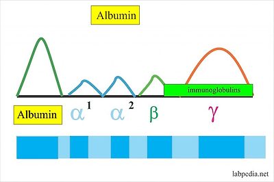albumin in electrophoresis albumin in electrophoresis