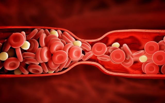 나쁜콜레스테롤 낮추는 음식 꿀의효능