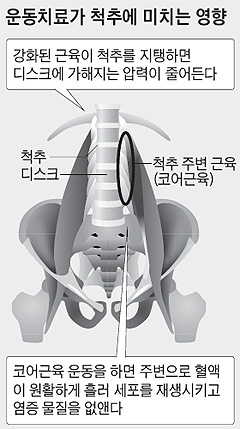 운동치료가 척추에 미치는 영향 - 그림 설명