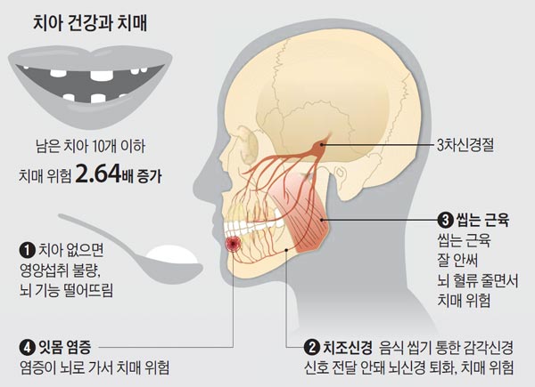 치아 건강과 치매