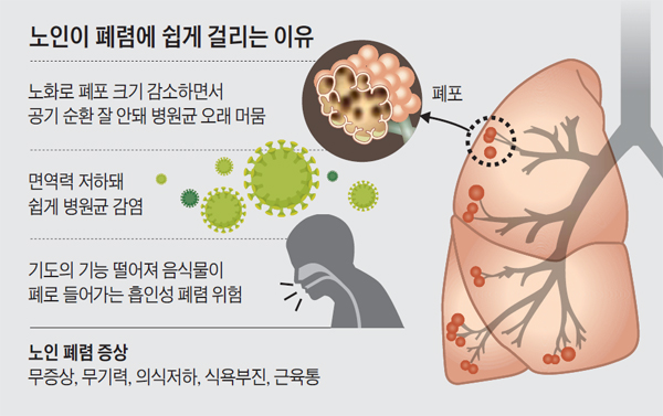 노인에게 폐렴 잘 생기는 이유 그래픽