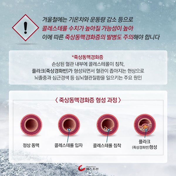 죽상동맥경화증 이미지