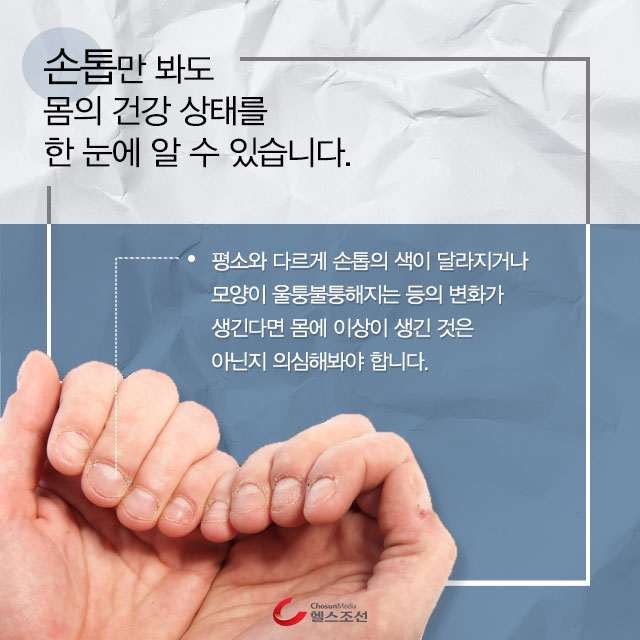 손 이미지