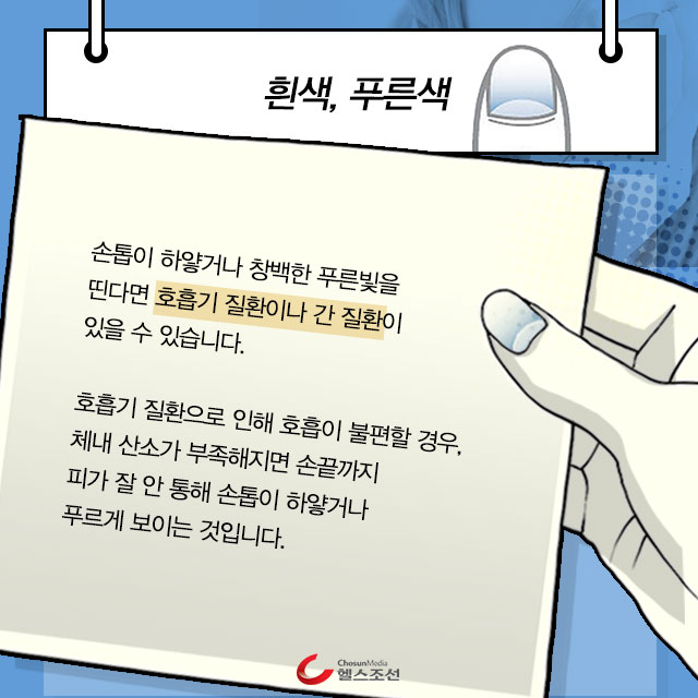 푸른색 손톱 이미지