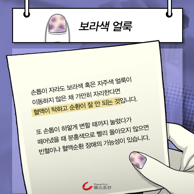 보라색 손톱 이미지