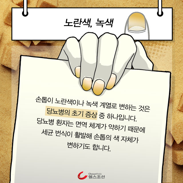 노란색 손톱 이미지