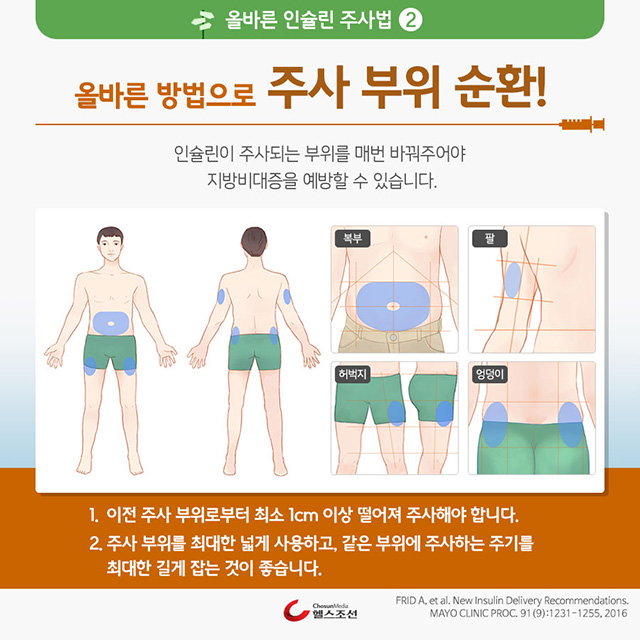 남성 주사 부위 이미지