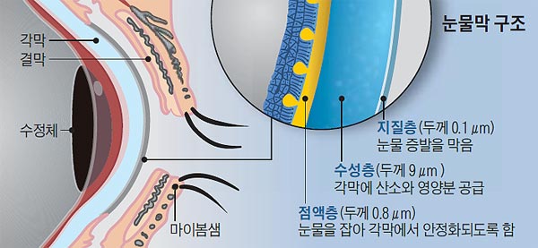 눈물막 구조