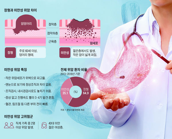 작은 암세포가 넓게 퍼진 미만성 위암은 악화 속도가 빠르고 특별한 증상이 없어 상태가 악화된 3·4기에 발견되는 경우가 많다. 