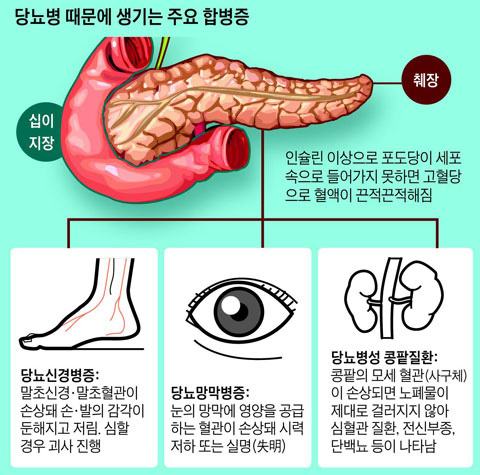 당뇨 합병증 그림