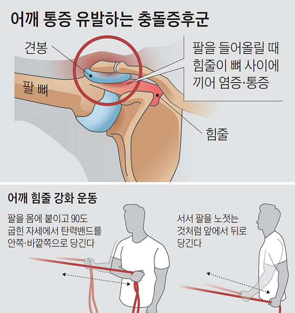 어깨 통증 유발하는 충돌증후군 외