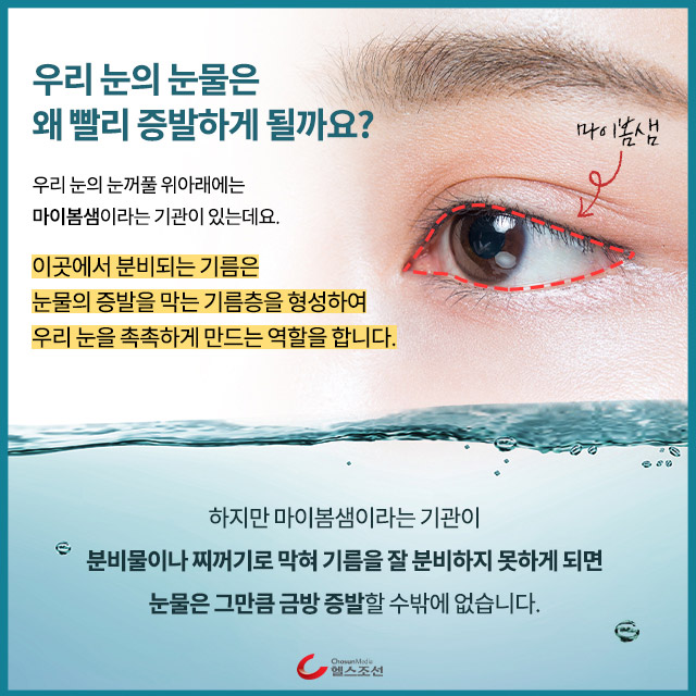 사진05 눈 마이봄샘 이미지