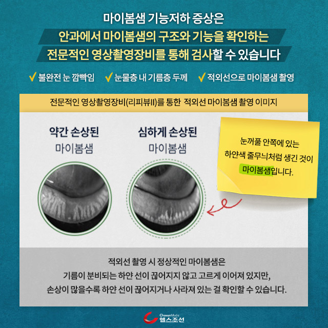 사진07 마이봄샘 손상 비교 이미지