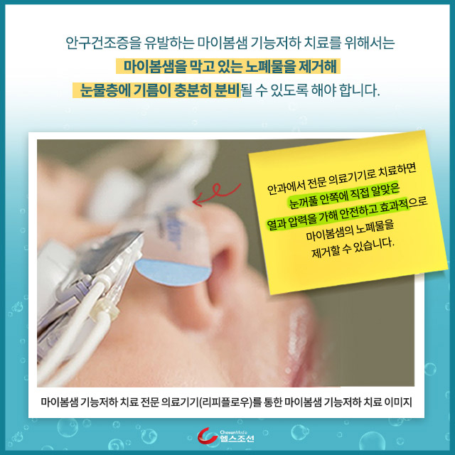 사진09 안과 치료/포스트잇 이미지