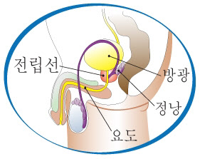 전립선 비대증 약 먹을 필요 없다