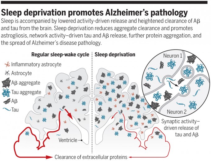 만성적인 수면장애는 치매의 위험성을 높인다는 연구결과가 잇달아 나오고 있다. 지난해에는 수면부족이 뇌에 이상 단백질인 아밀로이드베타와 타우 덩어리가 침착되는 걸 촉진한다는 사실이 밝혀졌다. 규칙적인 수면을 취하는 뇌(왼쪽)에 비해 수면부족인 뇌(오른쪽)에 아밀로이드베타 덩어리(Aβ aggregate)와 타우 덩어리(tau aggregate)가 더 많이 형성돼 있음을 보여주는 그림이다. ′사이언스′ 제공