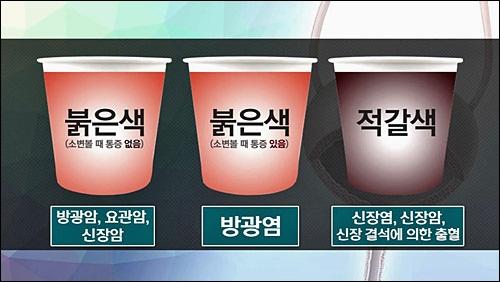 신장이에 대한 이미지 검색결과