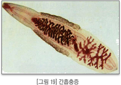 간흡충증