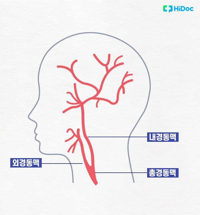 총경동맥과 내경동맥, 외경동맥
