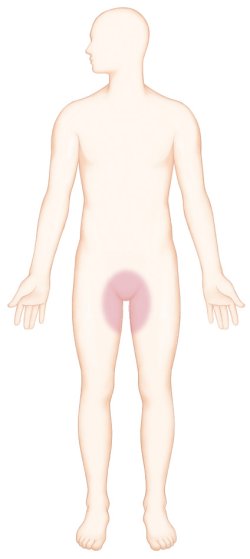 서혜부