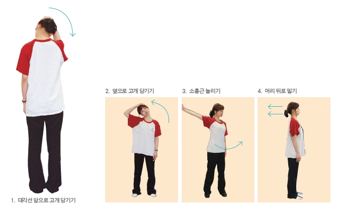 1. 대각선 앞으로 고개 당기기 2. 옆으로 고개 당기기 3. 소흉근 늘리기 4. 머리 뒤로 밀기등 목과 어깨의 통증 치료를 위한 간단한 스트레칭의 예시