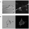 Figure 1. Confocal Microscopy showing FITC-labelled anti-NP-1 peptide binding to MDA-MB-231 (A) and 4T1 (B) mammary adenocarcinoma cells, (original magnification x 400).