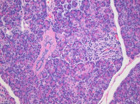 ‘랑게르한스의 작은 섬(islet of Langerhans)’은 소화액을 만드는 몽글몽글한 세포의 바다에 떠있는 느슨하게 보이는 세포집단이다. ⓒ 김대철 제공