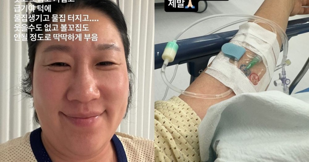 김영희 "처음 겪는 고통"…얼굴 몰라볼 정도로 부었다 [RE:스타]
