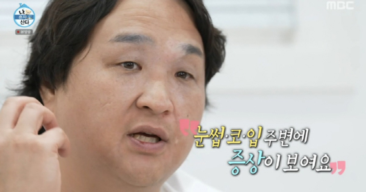 구성환, 백반증 부위 점점 넓어져 심각.."털이 다 하얗게 돼" ('나혼산')