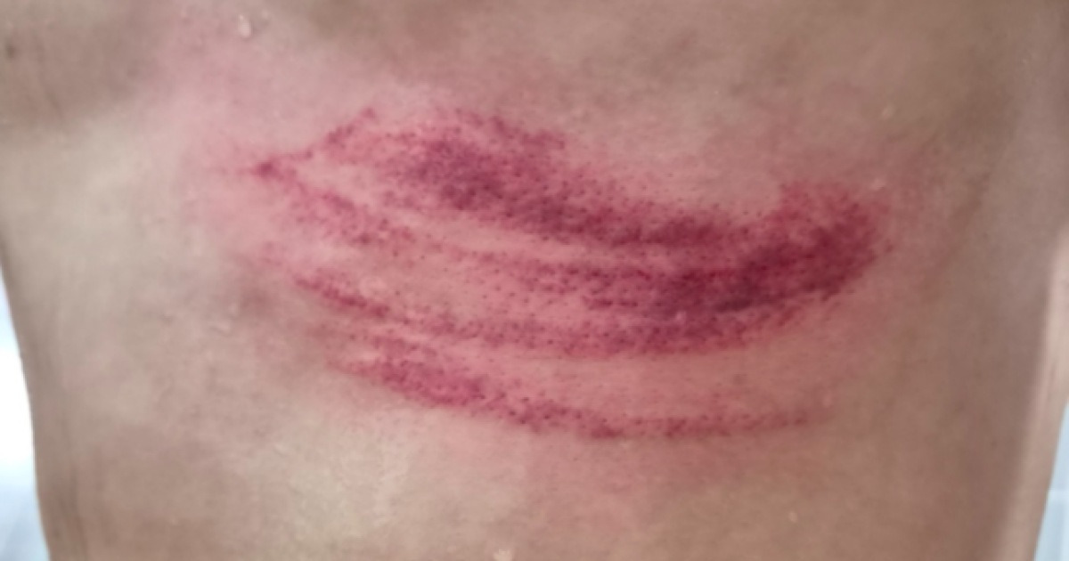 “갈비뼈 골절 아니었다” 쓰러진 최준, 예상 밖 결과…그러나 안심 못 한다